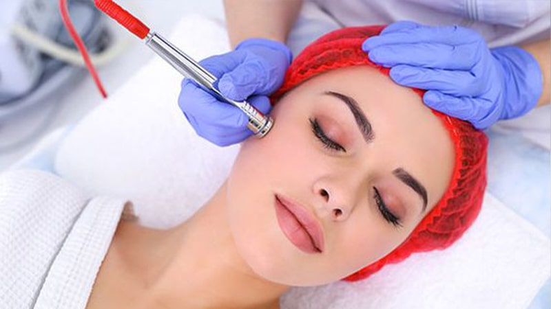 میکرونیدلینگ چگونه عمل می کند؟ میکرونیدلینگ چگونه عمل می کند؟